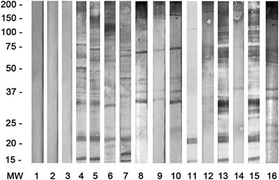 Seroepidemiological Study of Canine and Human Dirofilariasis in the Endemic Region of Northern Serbia